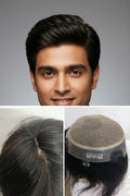 Australia mirage hair patch for men