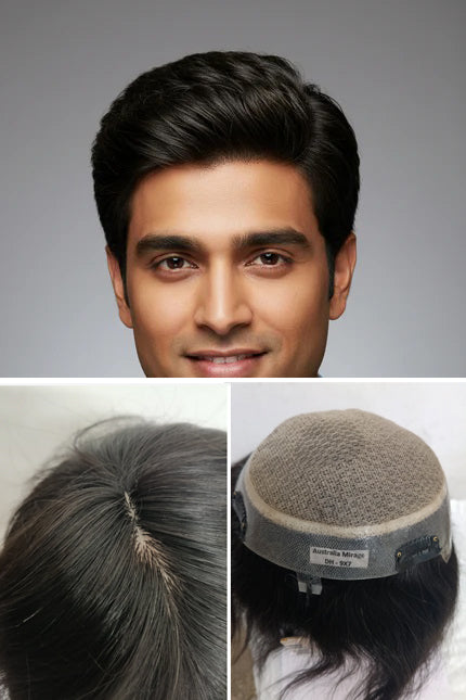 Australia mirage hair patch for men