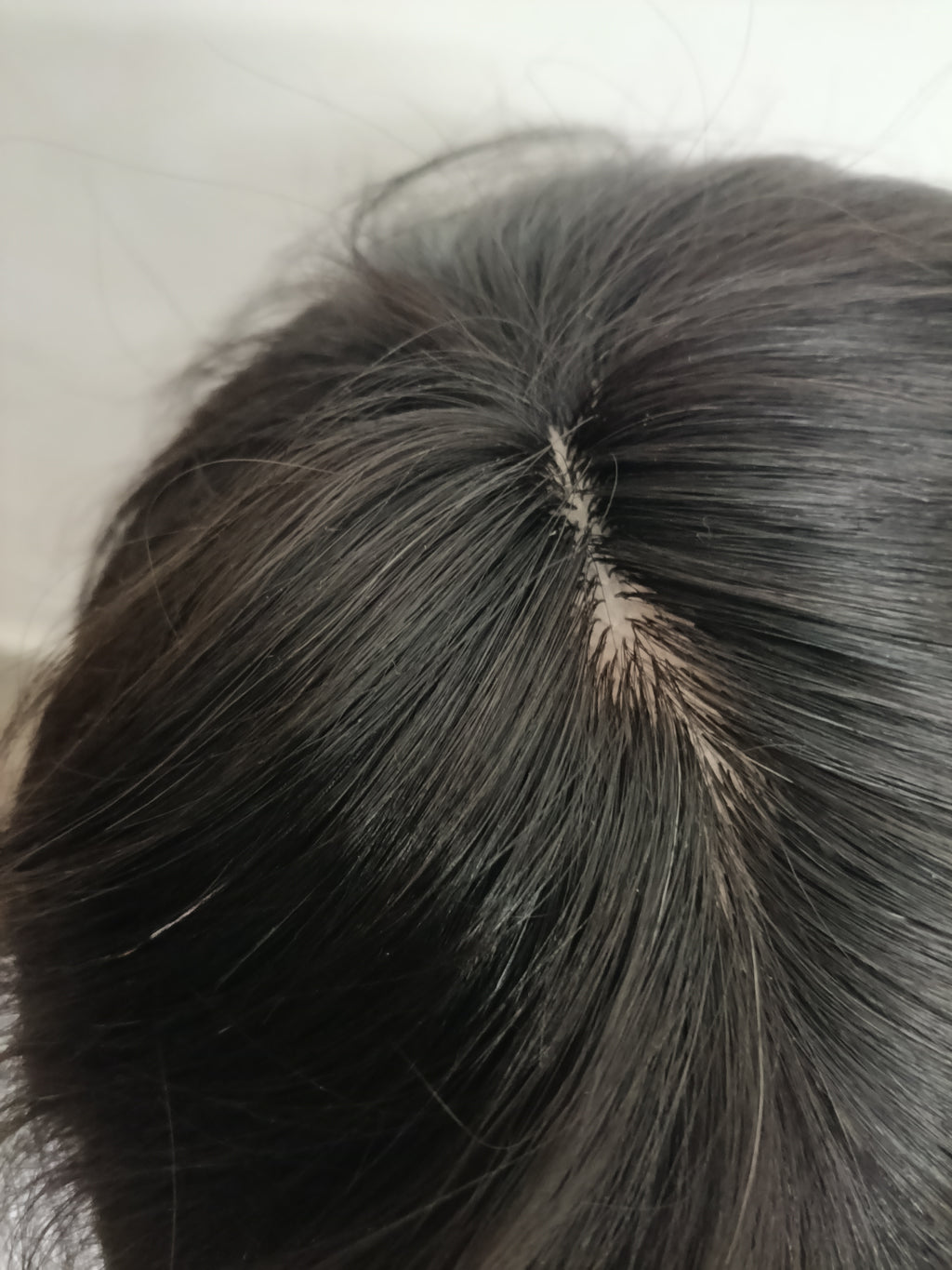 Australia mirage hair patch for men