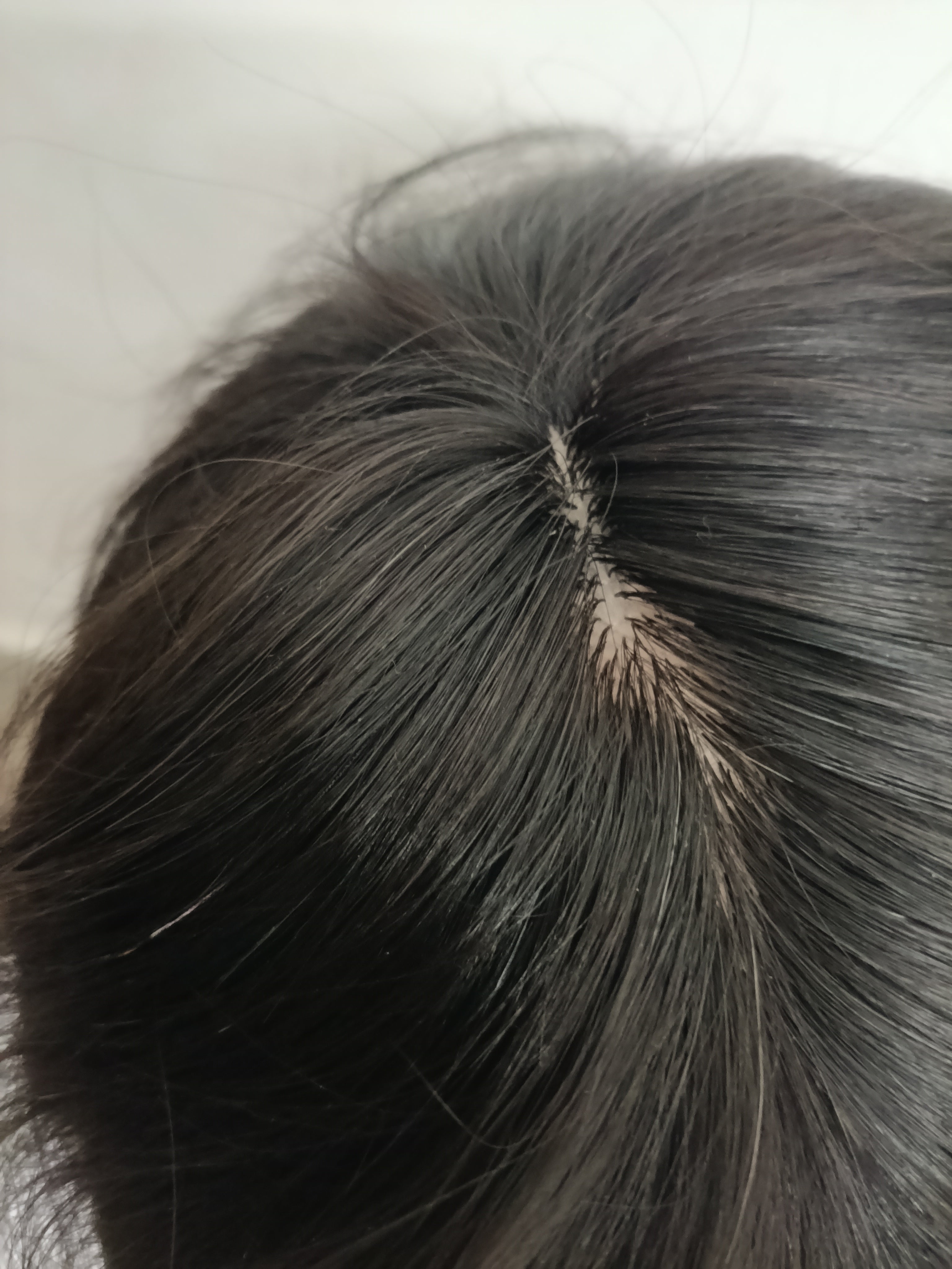 Australia mirage hair patch for men